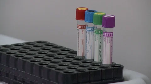 Test tubes putting in cetrifuge for analysis video Stock-Footage 108114672