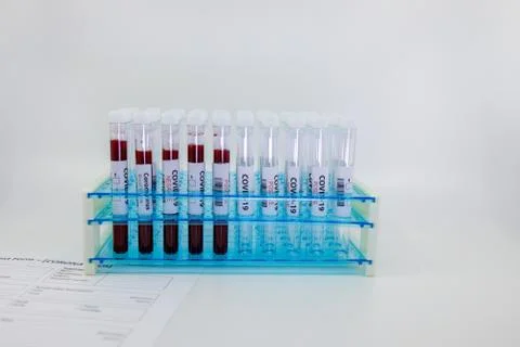 Test tubes rack with blood sample for coronavirus, covid-19 virus and empty t Stock Photos