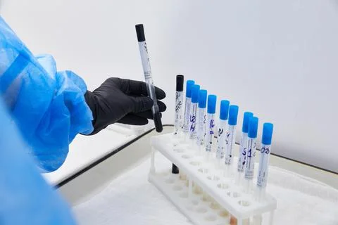 Test tubes rack with madical samples on the table at the modern laboratory 스톡 사진