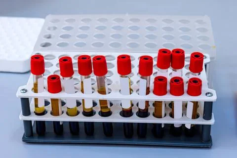 Test tubes with red caps in a rack on laboratory table Stock Photos
