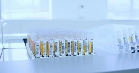 Test tubes with samples in a rack at laboratory 4k Stock Photos