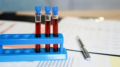 Test tubes on a stand and a flask with red blood on medical documents Stock-Fotos