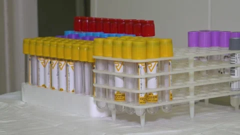 Test tubes in a stand on the table in the laboratory Stock Footage 144380905