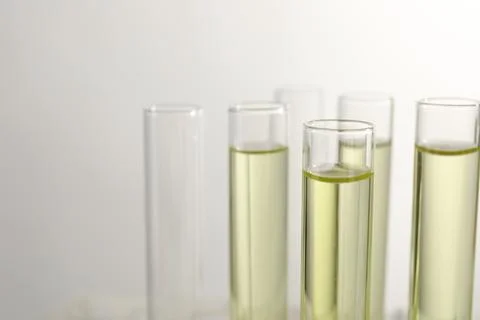 Test tubes with urine samples for analysis on light grey background, closeup Foto stock