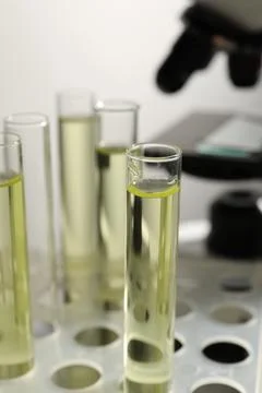 Test tubes with urine samples for analysis in holder on grey background, cl.. Foto stock