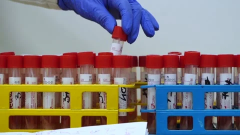 Test tubes with vaccine in lab hand takes test tube pkr test Stock Footage 149347658