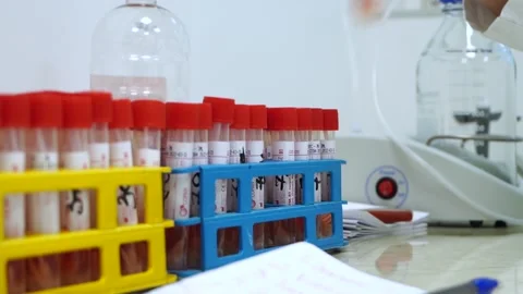 Test tubes with vaccine in lab hand takes test tube pkr test Stock Footage 149347699