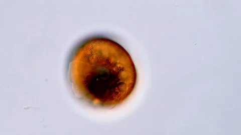 Testate amoeba, DIC microscope view 400x 動画素材 317787962