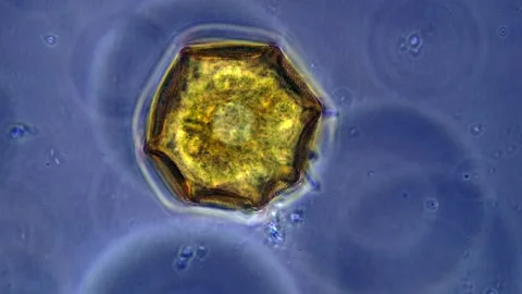 Testate amoeba movement (phase contrast, 40x lense) vibrant microscopy  Stock Footage 315420165