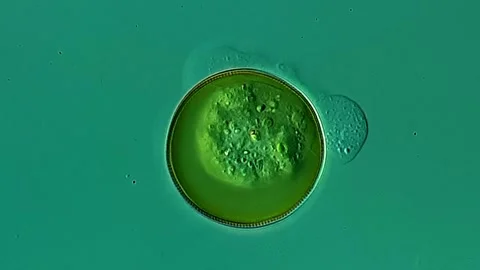 Testate amoeba in pond water under microscopy view Vidéo 306590259