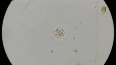 Testate amoeba under a microscope Stock Footage 93237923