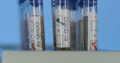 Testing biomedical COVID-19 research Stock Footage 127652440