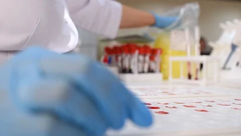 Testing of blood group and RH factor Stock Footage 98005197