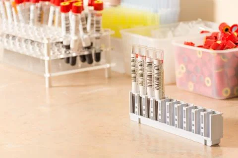Testing of blood samples for diseases and hormones Stock Photos