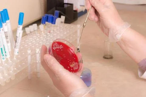 Testing of blood samples for diseases and hormones Stock Photos