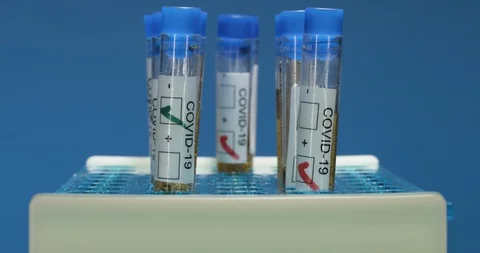 Testing for COVID-19 coronavirus lab work Stock Footage 127675397