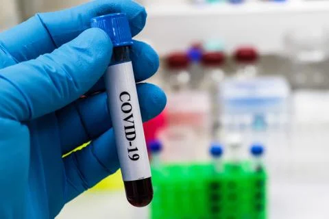 Testing on COVID-19. Stock Photos