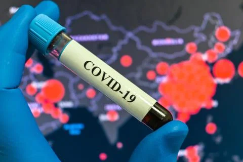 Testing on COVID-19. Stock-Fotos