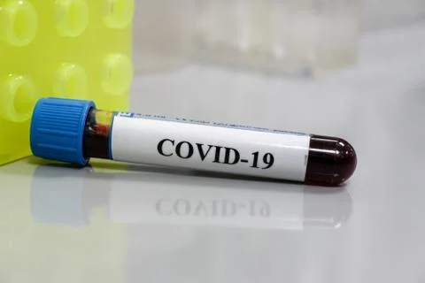 Testing on COVID-19. Stock Photos