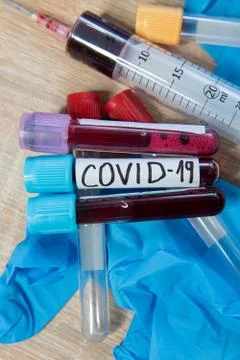 Testing at covid-19. Stock Photos