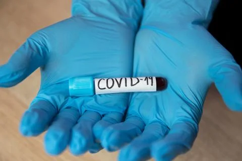 Testing at covid-19. Foto stock