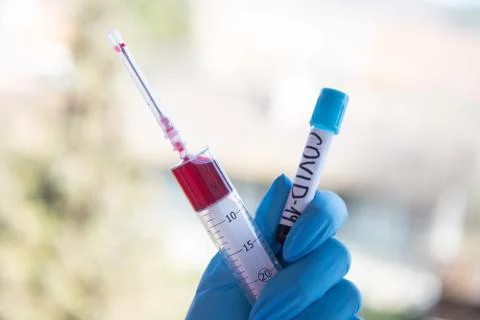 Testing at covid-19,sars and mers Stock Photos