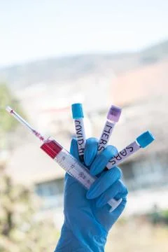 Testing at covid-19,sars and mers Stock Photos