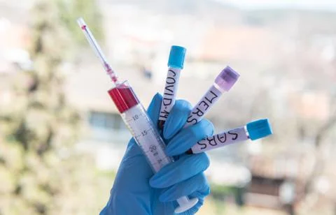 Testing at covid-19,sars and mers Stock Photos