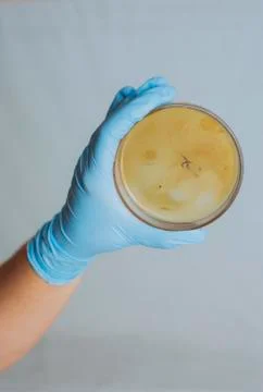 Testing for intestinal bacterial infection Stock Photos