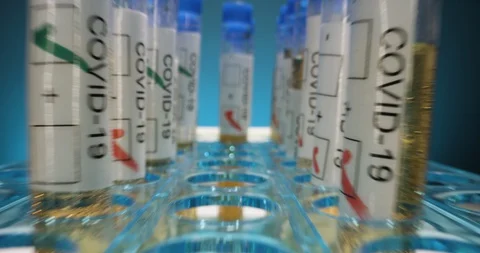 Testing positive for Coronavirus COVID-19 Stock Footage 127674792