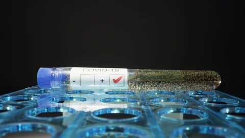 Testing positive for Coronavirus COVID-19 Stock Footage 128003602