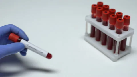 Testosterone, doctor showing blood sample in tube, lab research, health checkup Stock Footage 105159335