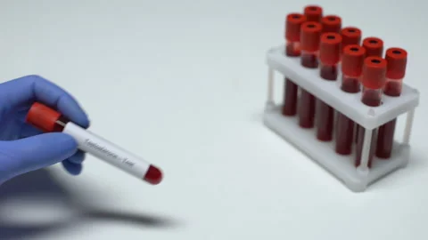 Testosterone, doctor showing blood sample in tube, lab research, health checkup Stock Footage 105202185
