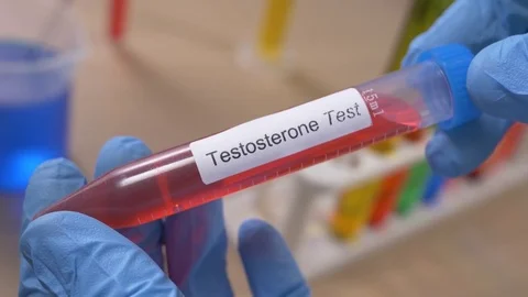 Testosterone Test Tube Being Hold By Scientist Closeup 스톡 동영상 77098737
