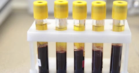 Tests for the biochemical identification of bacteria in test tubes Stock Footage 150458314