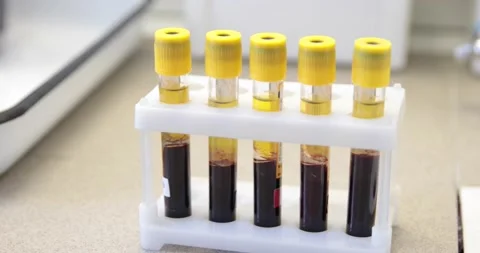 Tests for the biochemical identification of bacteria in test tubes Stock Footage 150458337