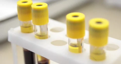 Tests for the biochemical identification of bacteria in test tubes Stock Footage 150458344