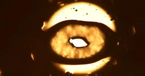 Tests Of Liquid Feces In A Under A Microscope Stock Footage 113178812