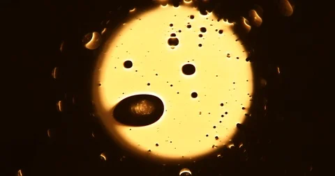 Tests Of Liquid Feces In A Under A Microscope Stock Footage 113178864