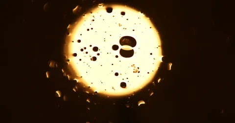 Tests Of Liquid Feces In A Under A Microscope Stock Footage 113178880