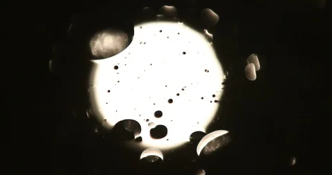 Tests Of Liquid Feces In A Under A Microscope Stock Footage 113179065