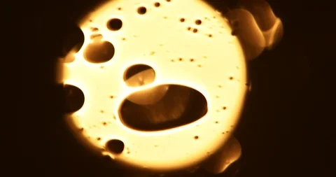 Tests Of Liquid Feces In A Under A Microscope Stock Footage 113179072