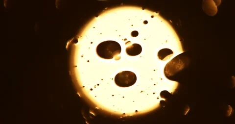 Tests Of Liquid Feces In A Under A Microscope Stock Footage 113179160