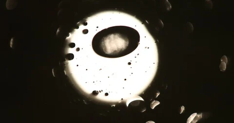 Tests Of Liquid Feces In A Under A Microscope Stock Footage 113179167