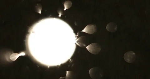 Tests Of Liquid Feces In A Under A Microscope Stock Footage 113179242