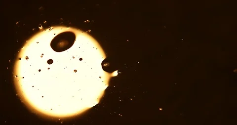 Tests Of Liquid Feces In A Under A Microscope Stock Footage 113179450