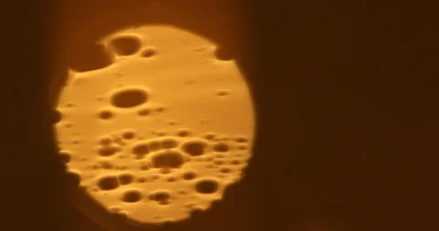 Tests Of Liquid Feces In A Under A Microscope Stock Footage 113179479