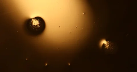 Tests Of Liquid Feces In A Under A Microscope Stock Footage 113179496