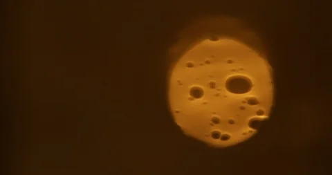 Tests Of Liquid Feces In A Under A Microscope Stock Footage 113179511