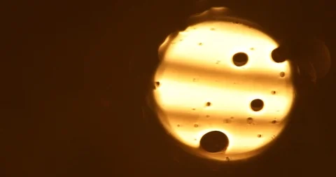 Tests Of Liquid Feces In A Under A Microscope Stock Footage 113179712